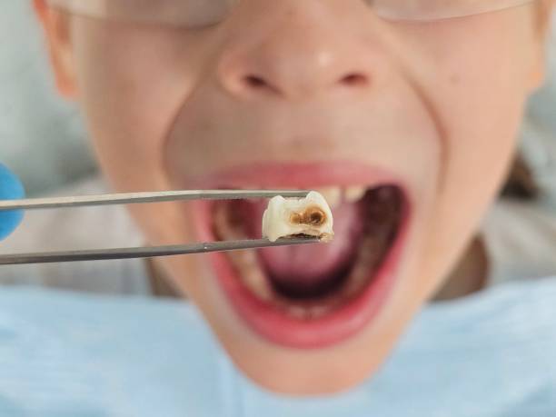 Best Tooth Pain Emergency Relief  in Riceville, TN