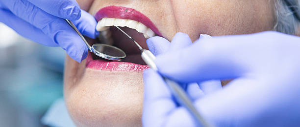 Best Dentist for Tooth Abscess  in Riceville, TN